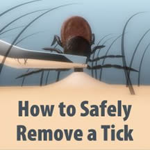 NYS DOH How to Safely Remove A Tick Card